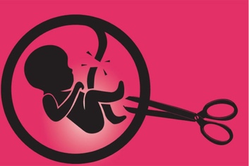 Искусственный аборт